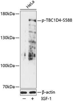 Western blot - Phospho-TBC1D4-S588 antibody (AP0790)