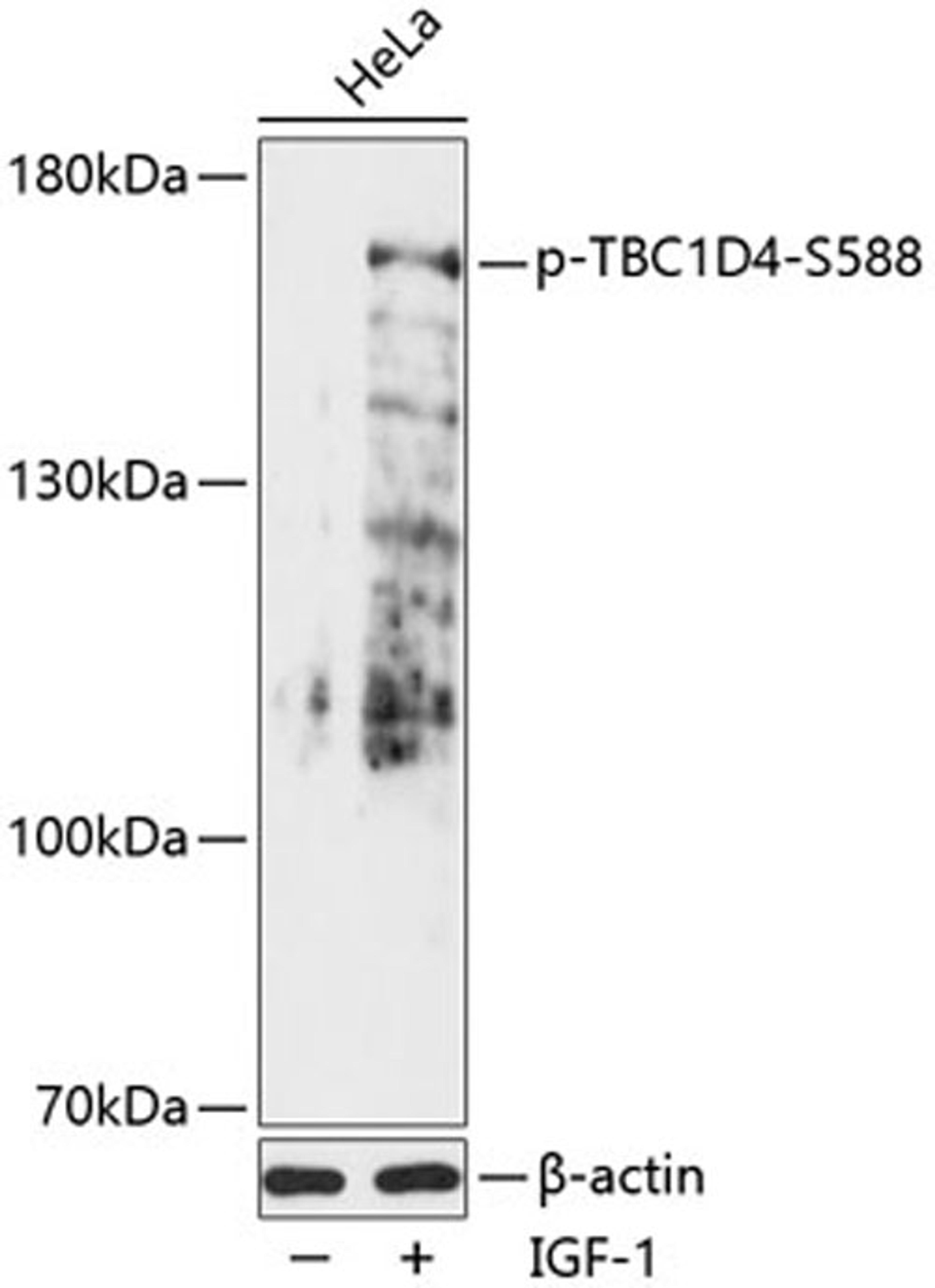 Western blot - Phospho-TBC1D4-S588 antibody (AP0790)