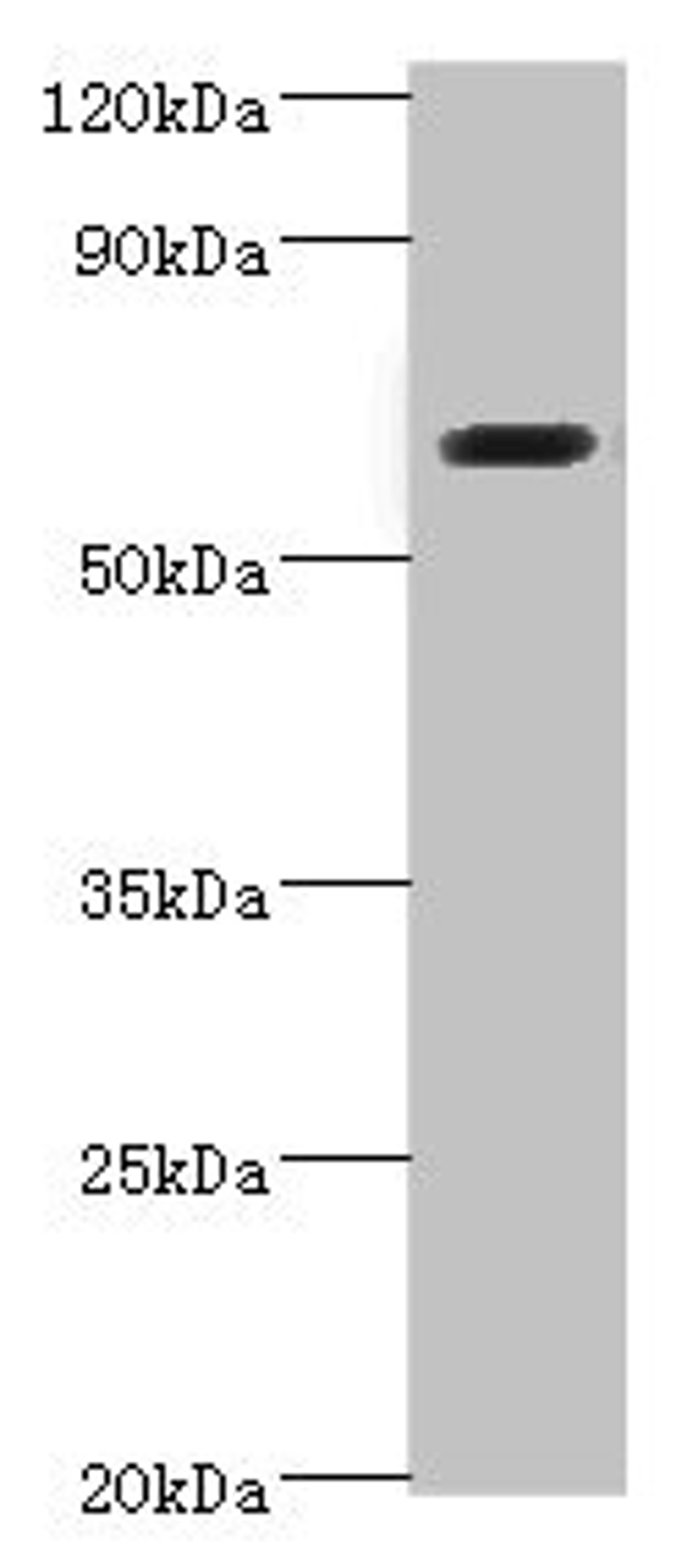 Western blot. All lanes: SHC4 antibody at 6ug/ml + Jurkat whole cell lysate. Secondary. Goat polyclonal to rabbit IgG at 1/10000 dilution. Predicted band size: 69, 43 kDa. Observed band size: 69 kDa.