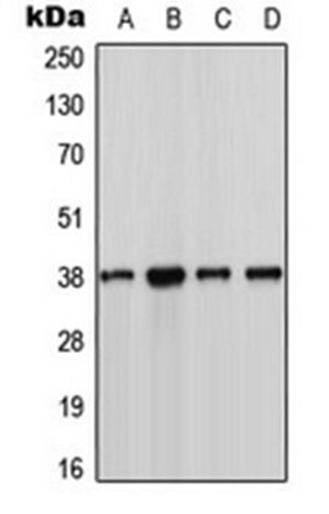 Western blot analysis of MCF7 (Lane 1), Jurkat (Lane 2), NIH3T3 (Lane 3), H9C2 (Lane 4) whole cell lysates using CSNK1A1 antibody