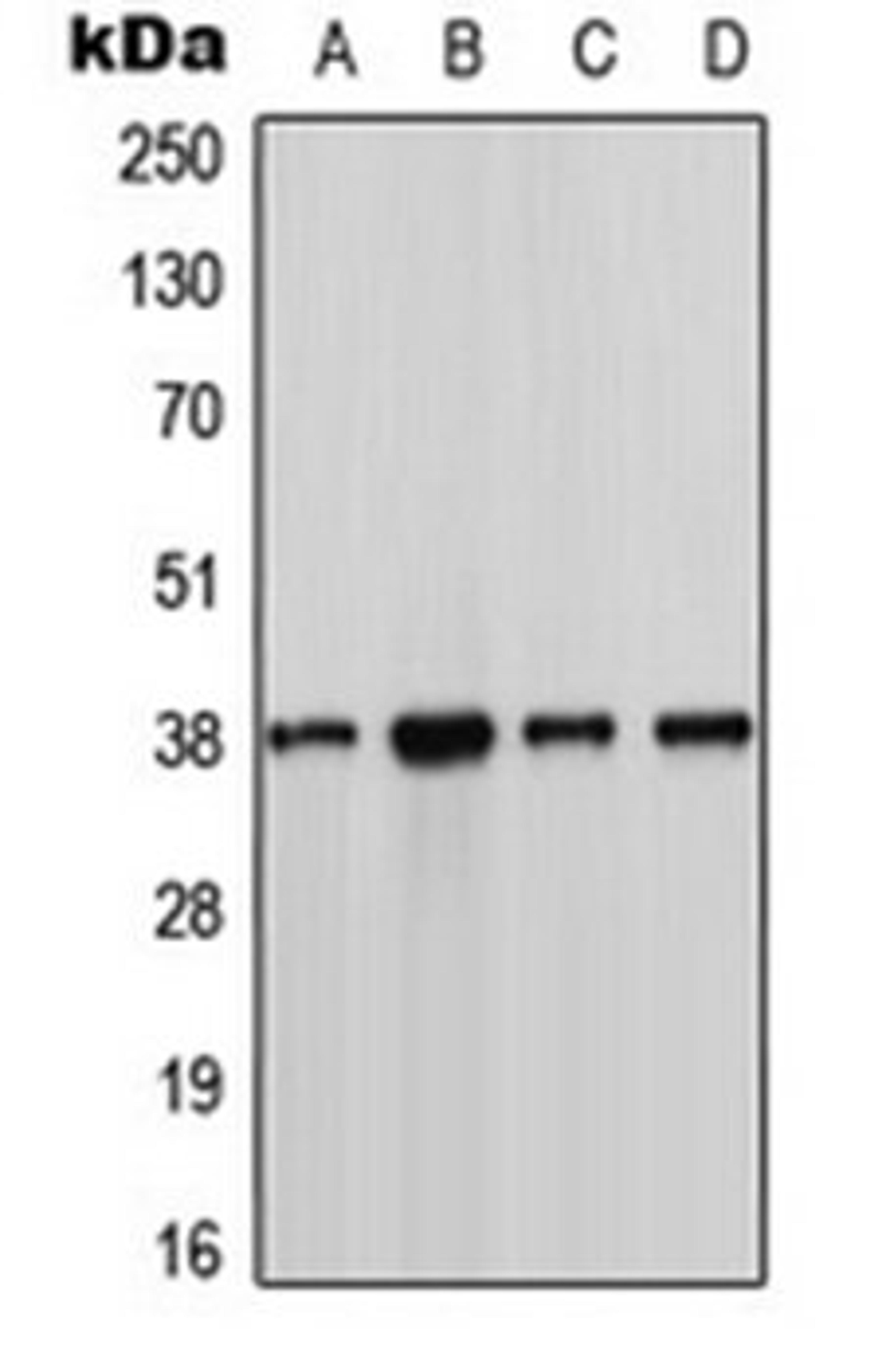 Western blot analysis of MCF7 (Lane 1), Jurkat (Lane 2), NIH3T3 (Lane 3), H9C2 (Lane 4) whole cell lysates using CSNK1A1 antibody