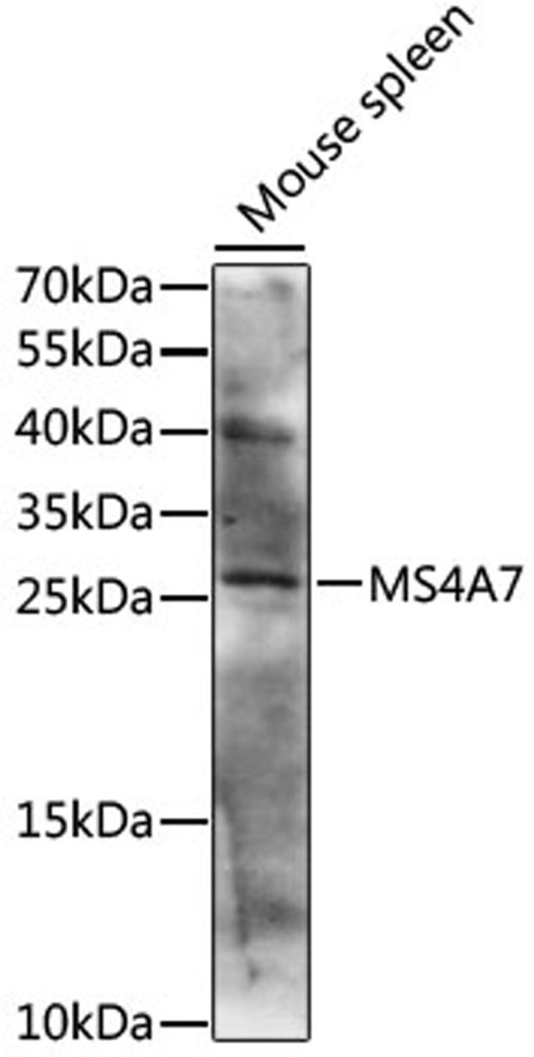 Western blot - MS4A7 antibody (A15495)