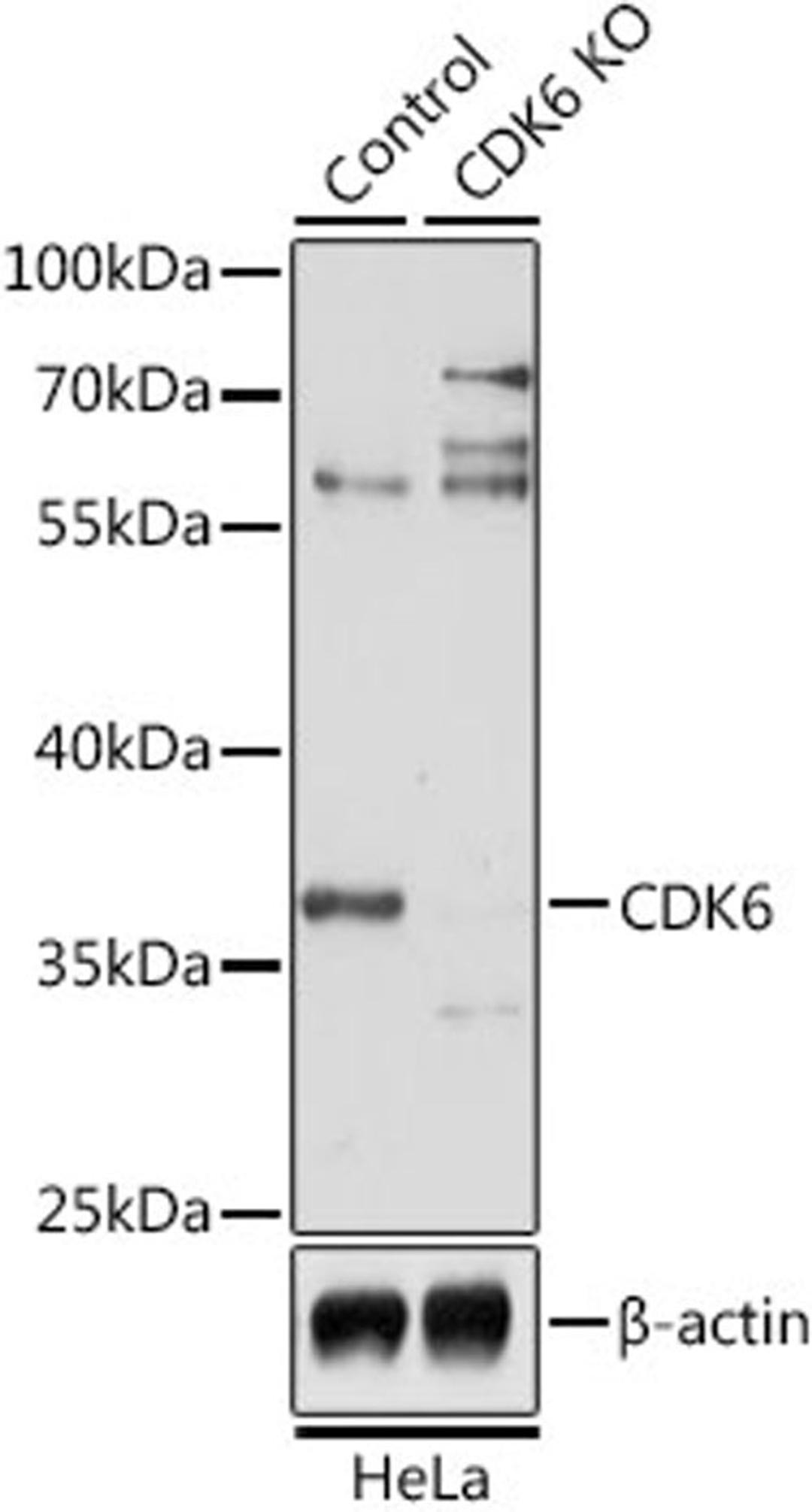 Western blot - CDK6 antibody (A1545)