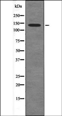 Western blot analysis of nocodazole treated HeLa whole cell lysates using PDGFRa -Phospho-Tyr720- antibody