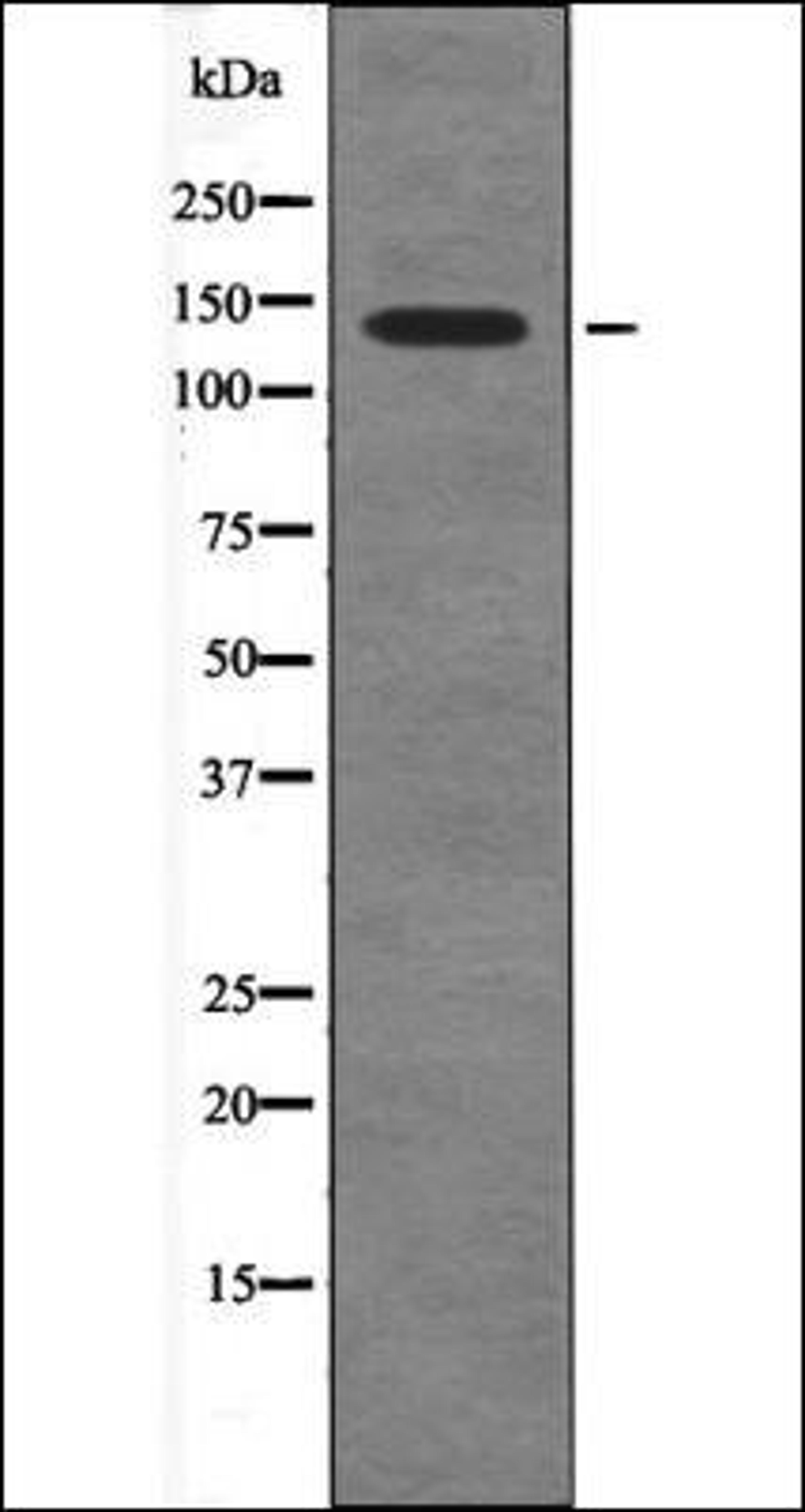 Western blot analysis of nocodazole treated HeLa whole cell lysates using PDGFRa -Phospho-Tyr720- antibody