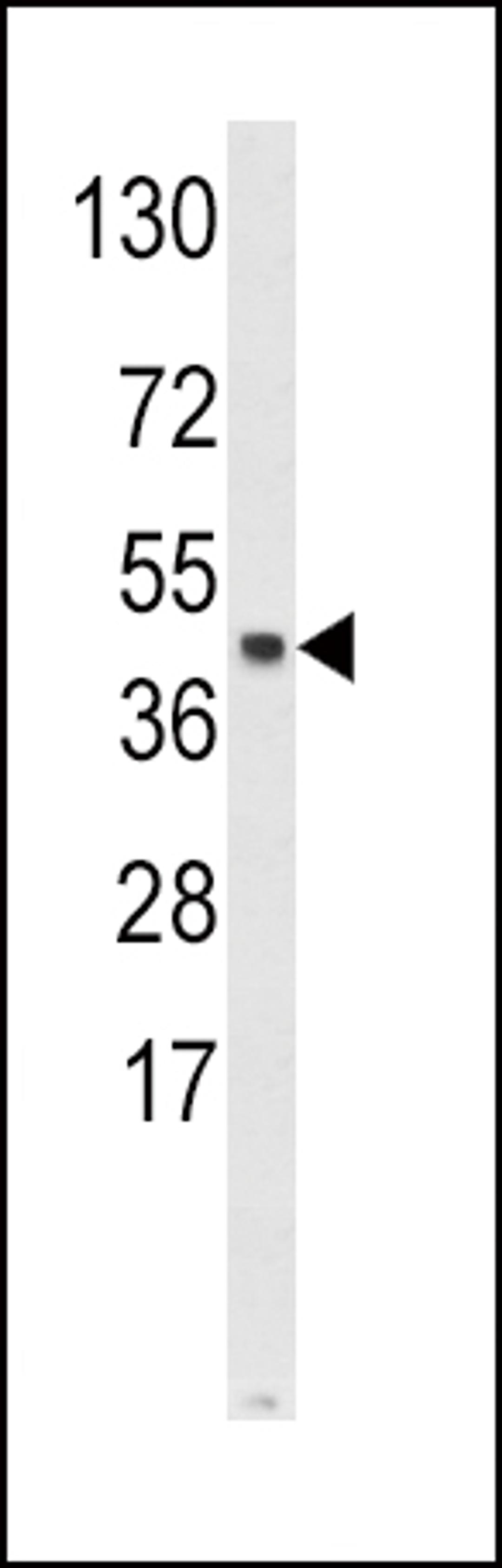 Western blot analysis of SKP2 Antibody in Hela cell line lysates (35ug/lane)