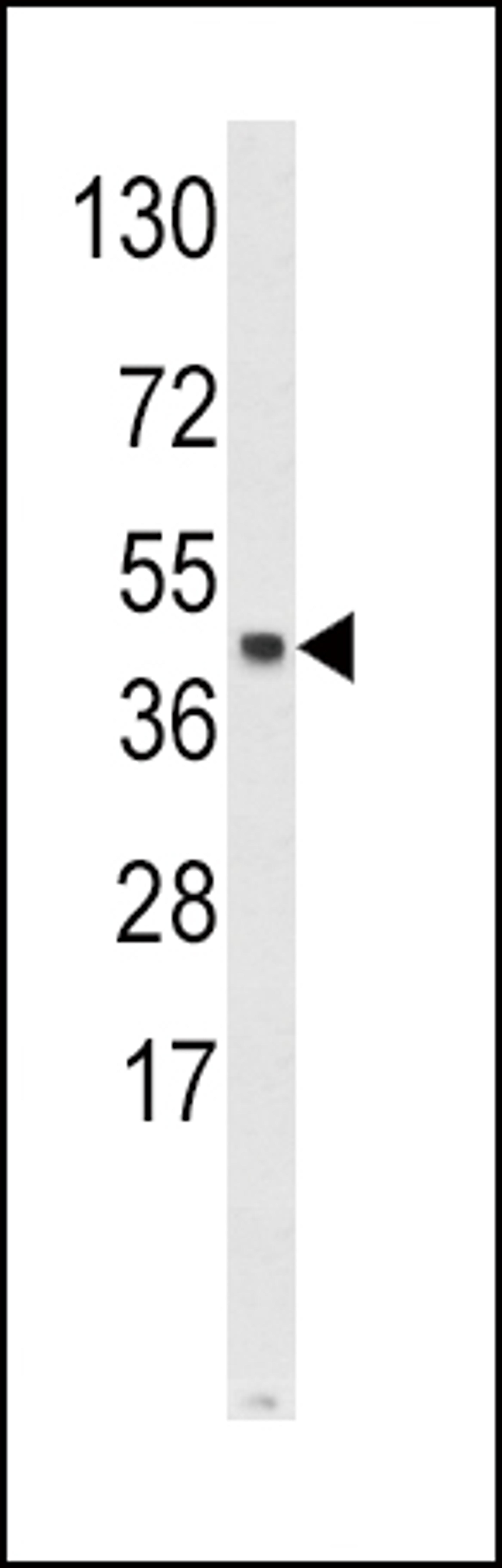 Western blot analysis of SKP2 Antibody in Hela cell line lysates (35ug/lane)