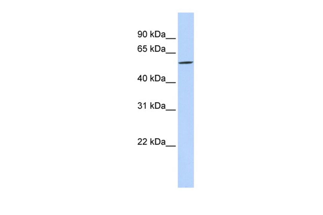 Antibody used in WB on Human MCF-7 at 0.2-1 ug/ml.