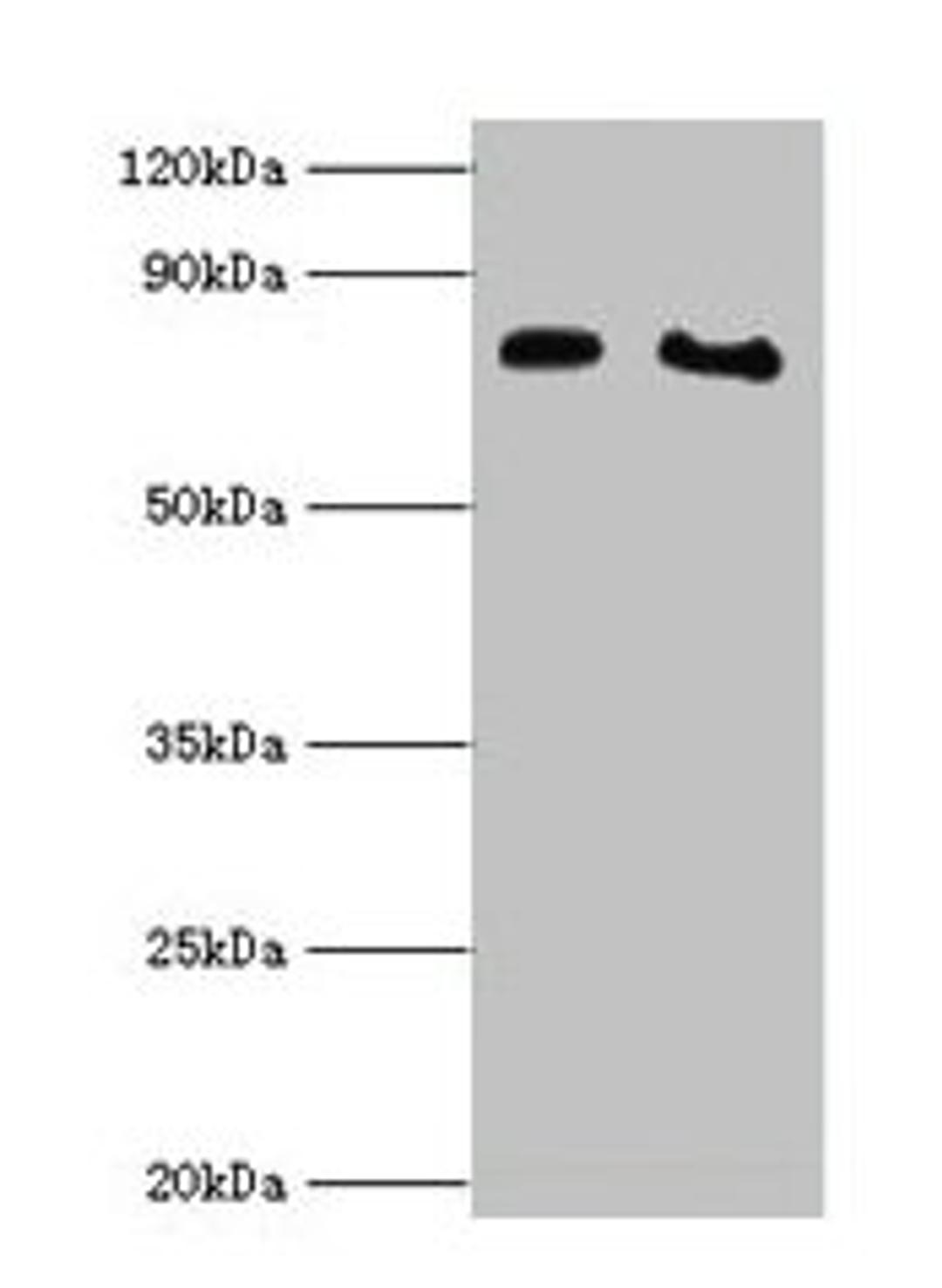 Western blot. All lanes: POR antibody at 2µg/ml. Lane 1: K562 whole cell lysate. Lane 2: A431 whole cell lysate. Secondary. Goat polyclonal to rabbit IgG at 1/10000 dilution. Predicted band size: 77 kDa. Observed band size: 77 kDa