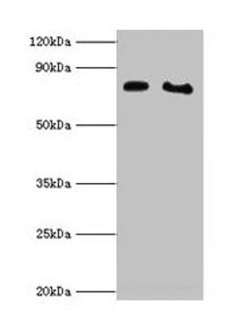 Western blot. All lanes: POR antibody at 2µg/ml. Lane 1: K562 whole cell lysate. Lane 2: A431 whole cell lysate. Secondary. Goat polyclonal to rabbit IgG at 1/10000 dilution. Predicted band size: 77 kDa. Observed band size: 77 kDa