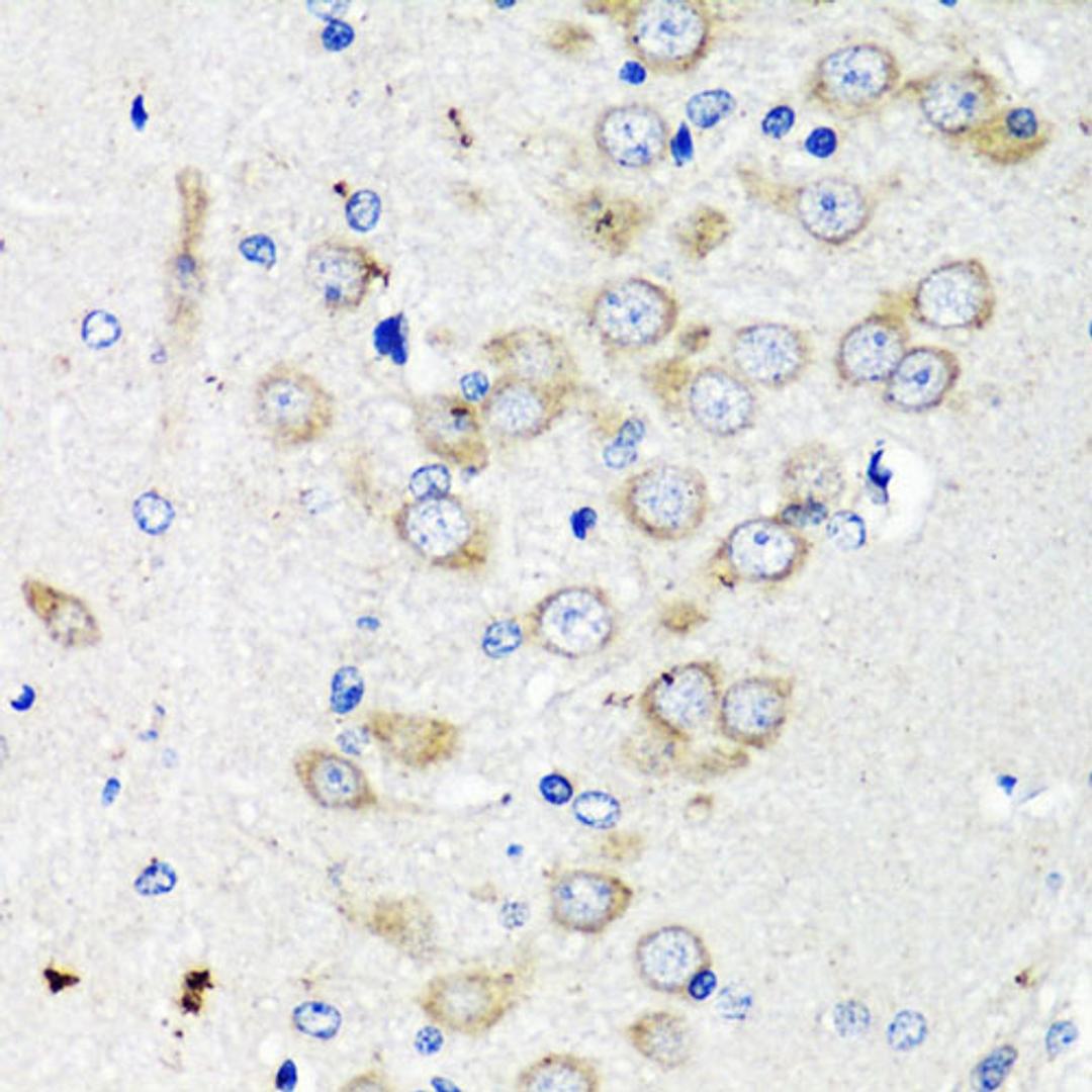Immunohistochemistry - TSC2 antibody (A0492)