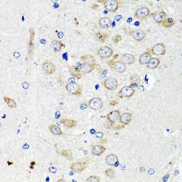 Immunohistochemistry - TSC2 antibody (A0492)