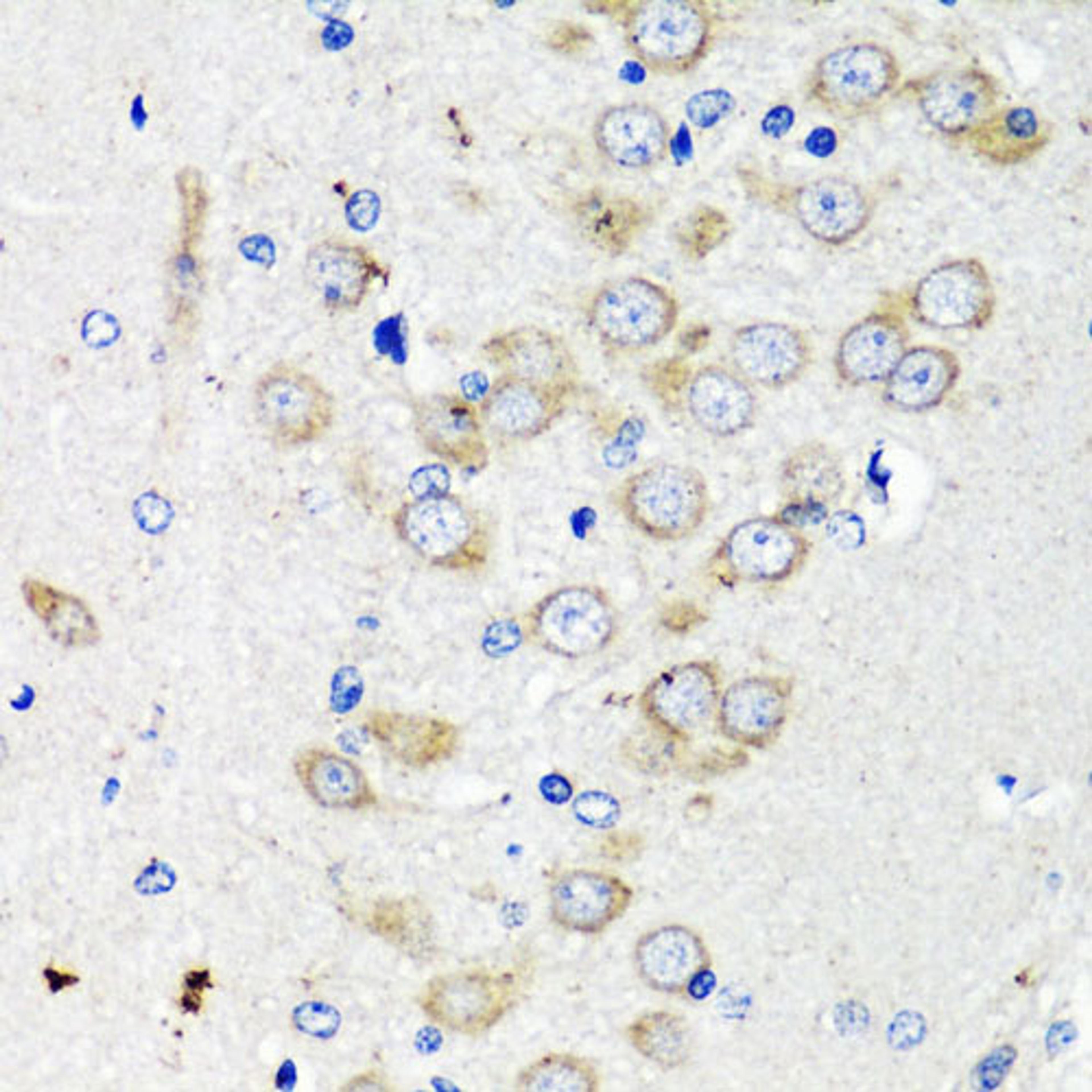 Immunohistochemistry - TSC2 antibody (A0492)