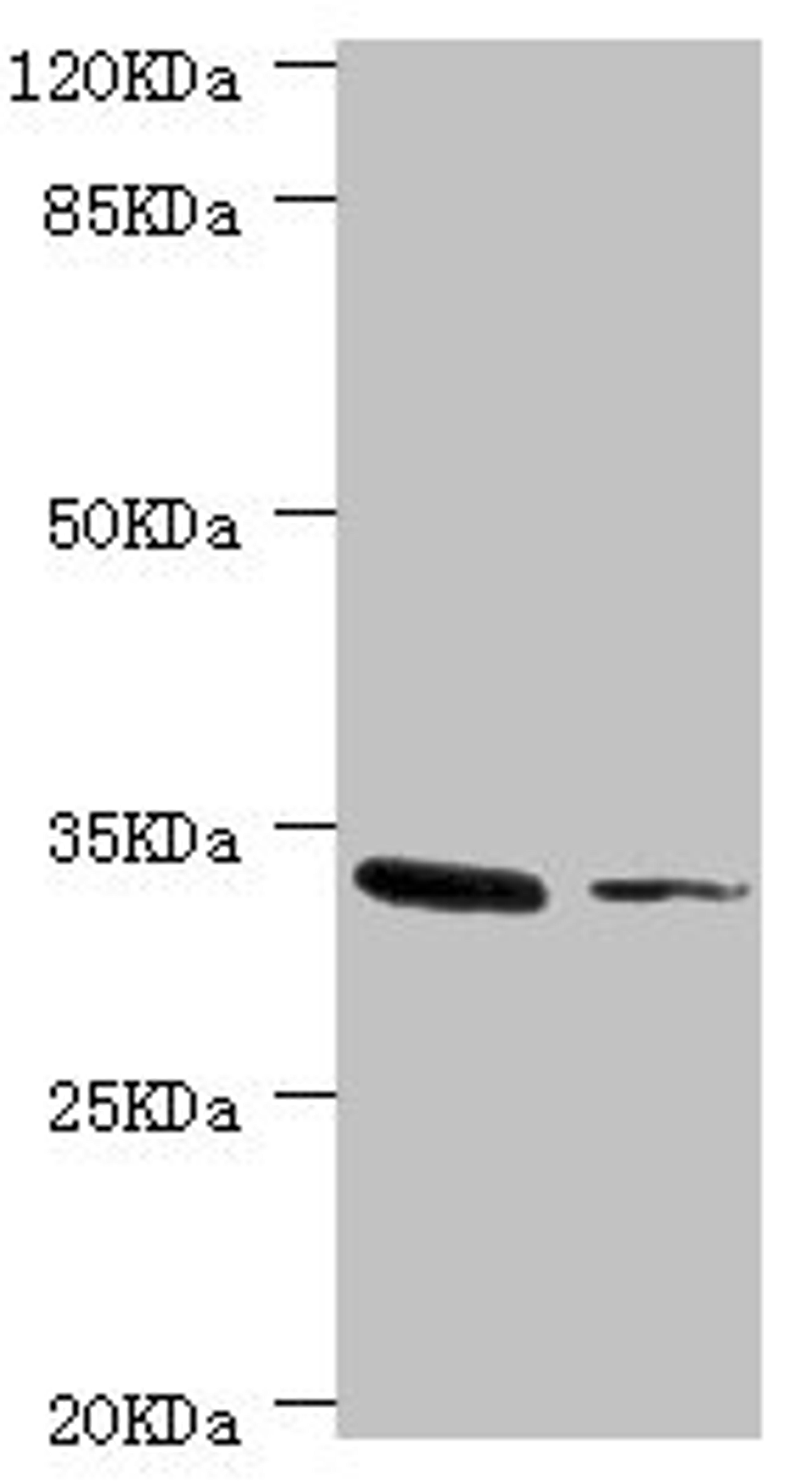 Western blot. All lanes: MGLL antibody at 2.37ug/ml. Lane 1: Mouse liver tissue. Lane 2: HT-29 whole cell lysate. Secondary. Goat polyclonal to rabbit IgG at 1/10000 dilution. Predicted band size: 34, 32 kDa. Observed band size: 34 kDa. 