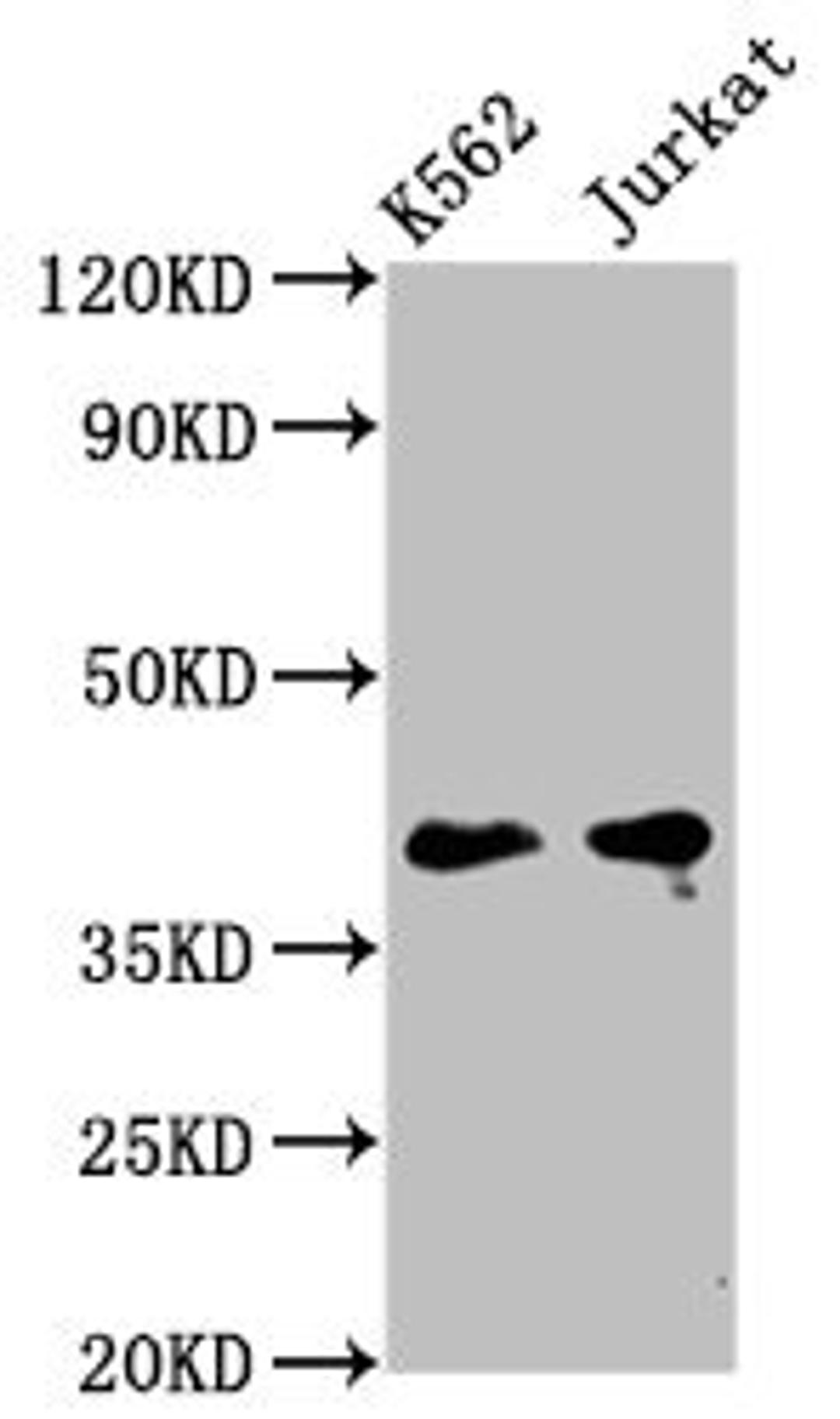 Western Blot. Positive WB detected in: K562 whole cell lysate, Jurkat whole cell lysate. All lanes: PURG antibody at 5µg/ml. Secondary. Goat polyclonal to rabbit IgG at 1/50000 dilution. Predicted band size: 40, 37 kDa. Observed band size: 40 kDa