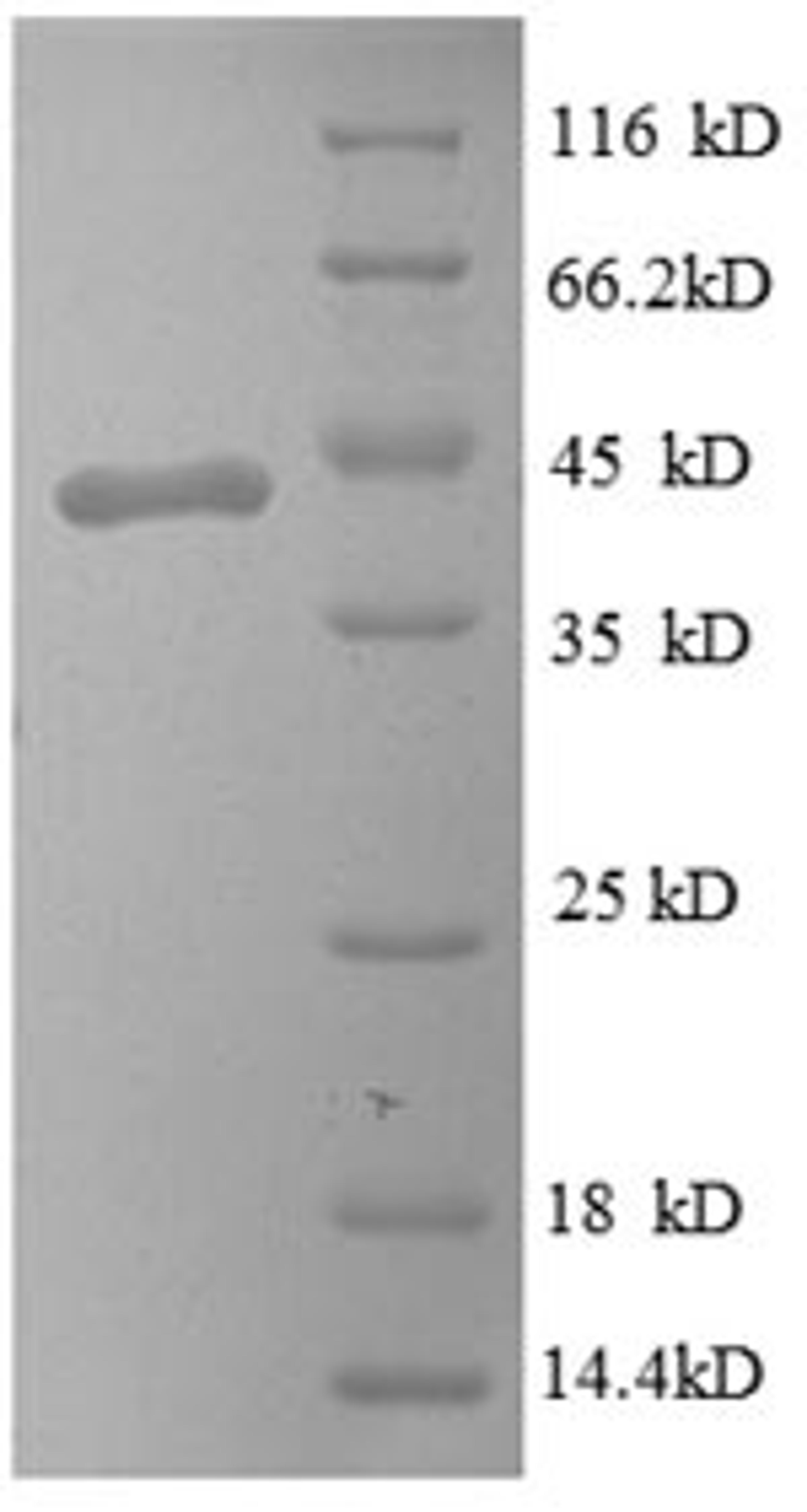 (Tris-Glycine gel) Discontinuous SDS-PAGE (reduced) with 5% enrichment gel and 15% separation gel.