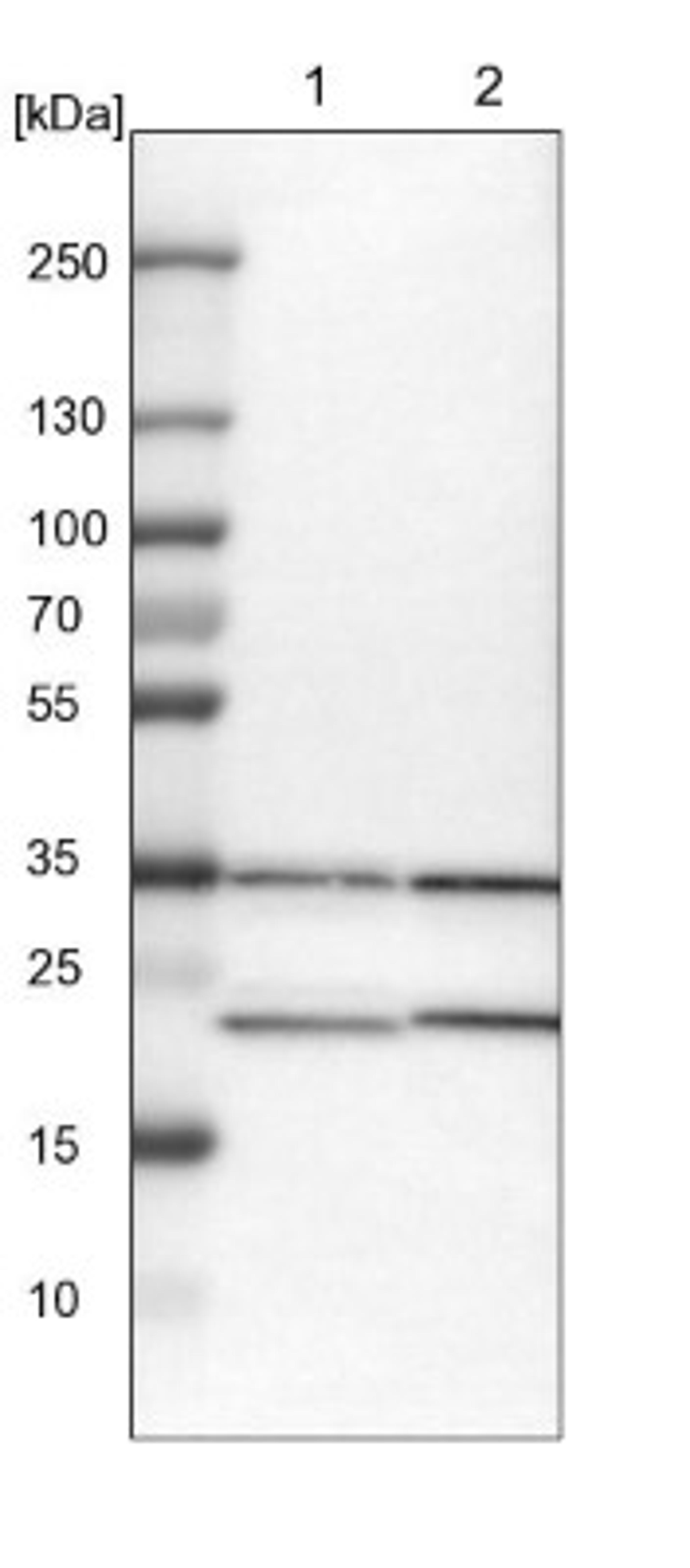 Western Blot: ZNF313 Antibody [NBP1-87204] - Lane 1: NIH-3T3 cell lysate (Mouse embryonic fibroblast cells)<br/>Lane 2: NBT-II cell lysate (Rat Wistar bladder tumour cells)