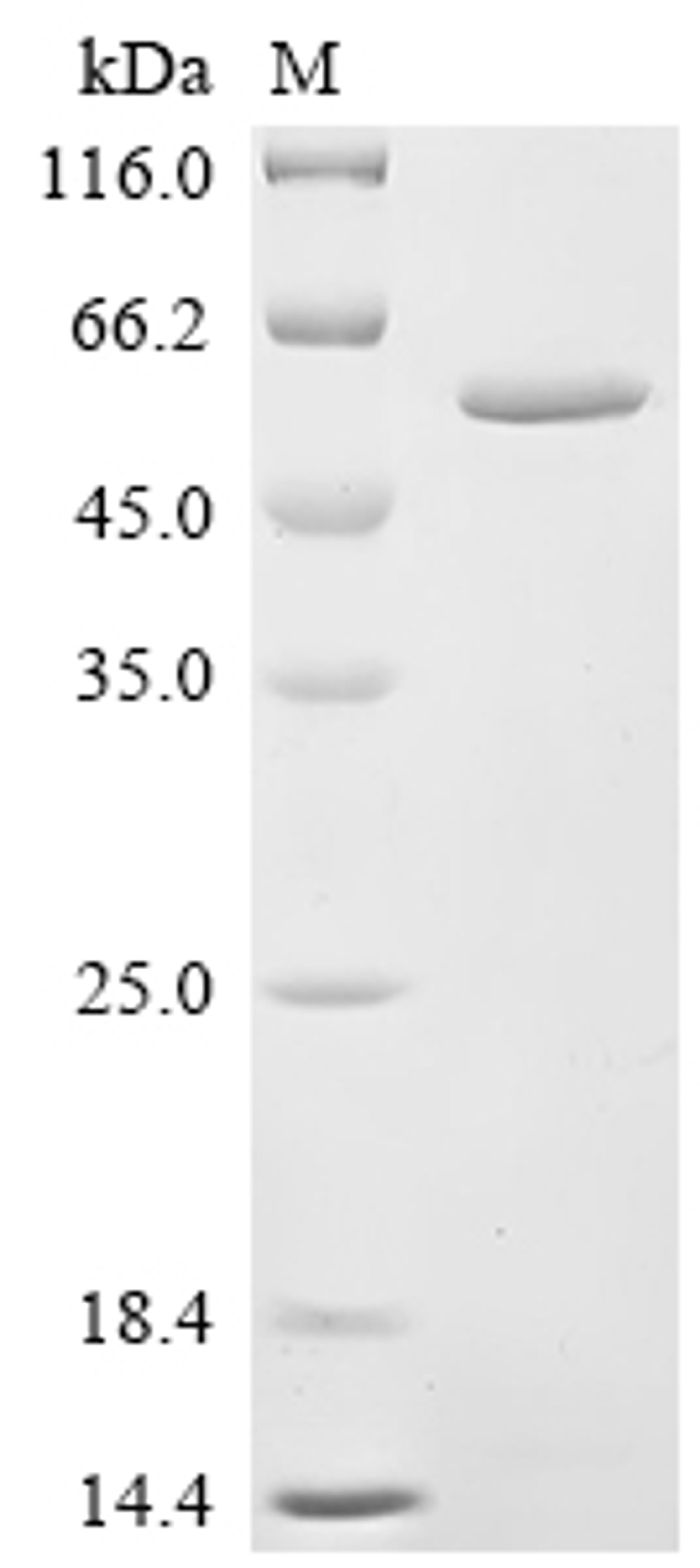 (Tris-Glycine gel) Discontinuous SDS-PAGE (reduced) with 5% enrichment gel and 15% separation gel.