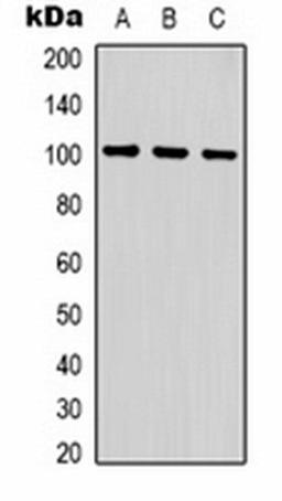 Western blot analysis of  human brain (Lane1), mouse brain (Lane2), rat brain (Lane3) whole cell lysates using GLUR1 antibody