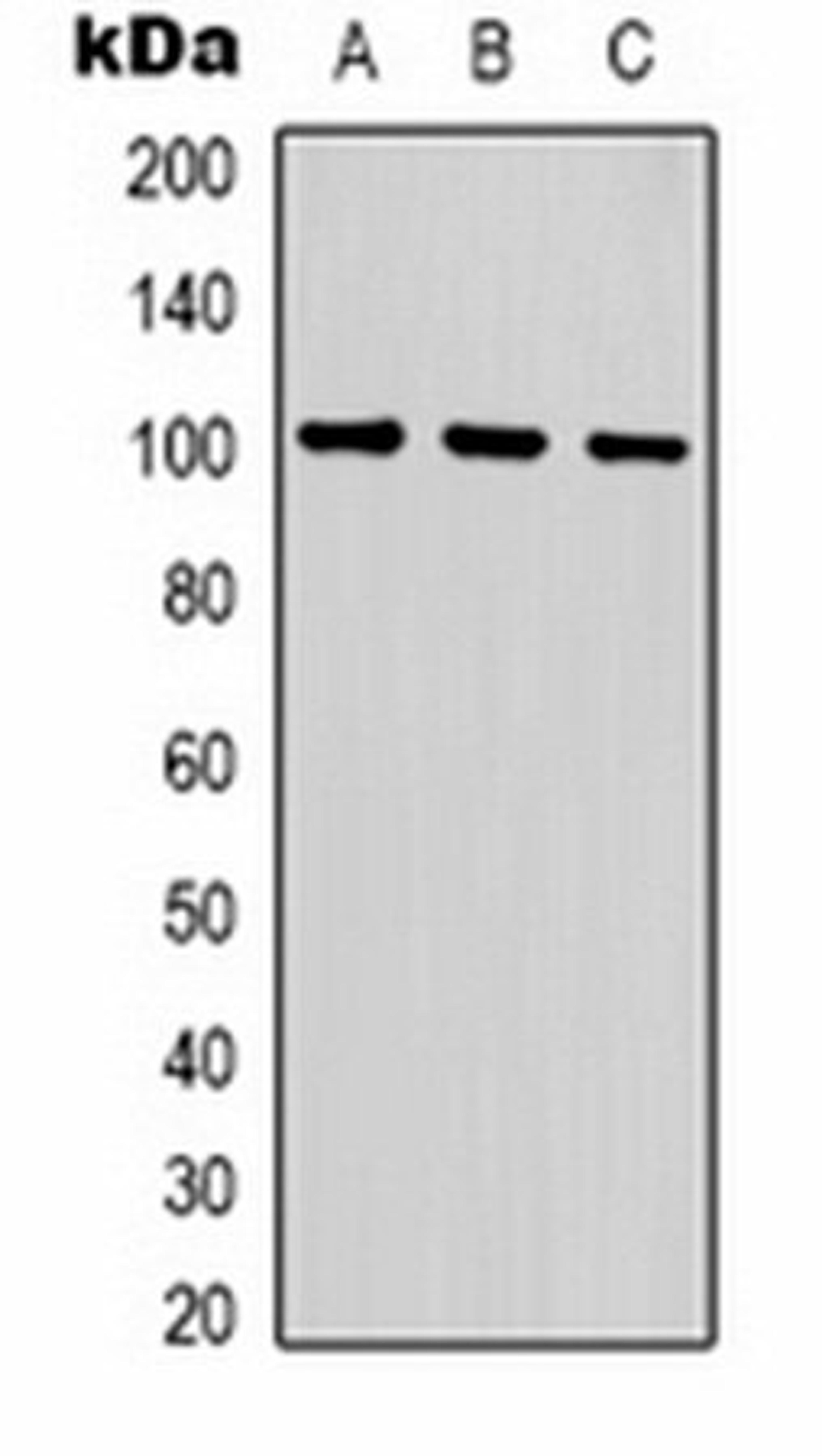 Western blot analysis of  human brain (Lane1), mouse brain (Lane2), rat brain (Lane3) whole cell lysates using GLUR1 antibody