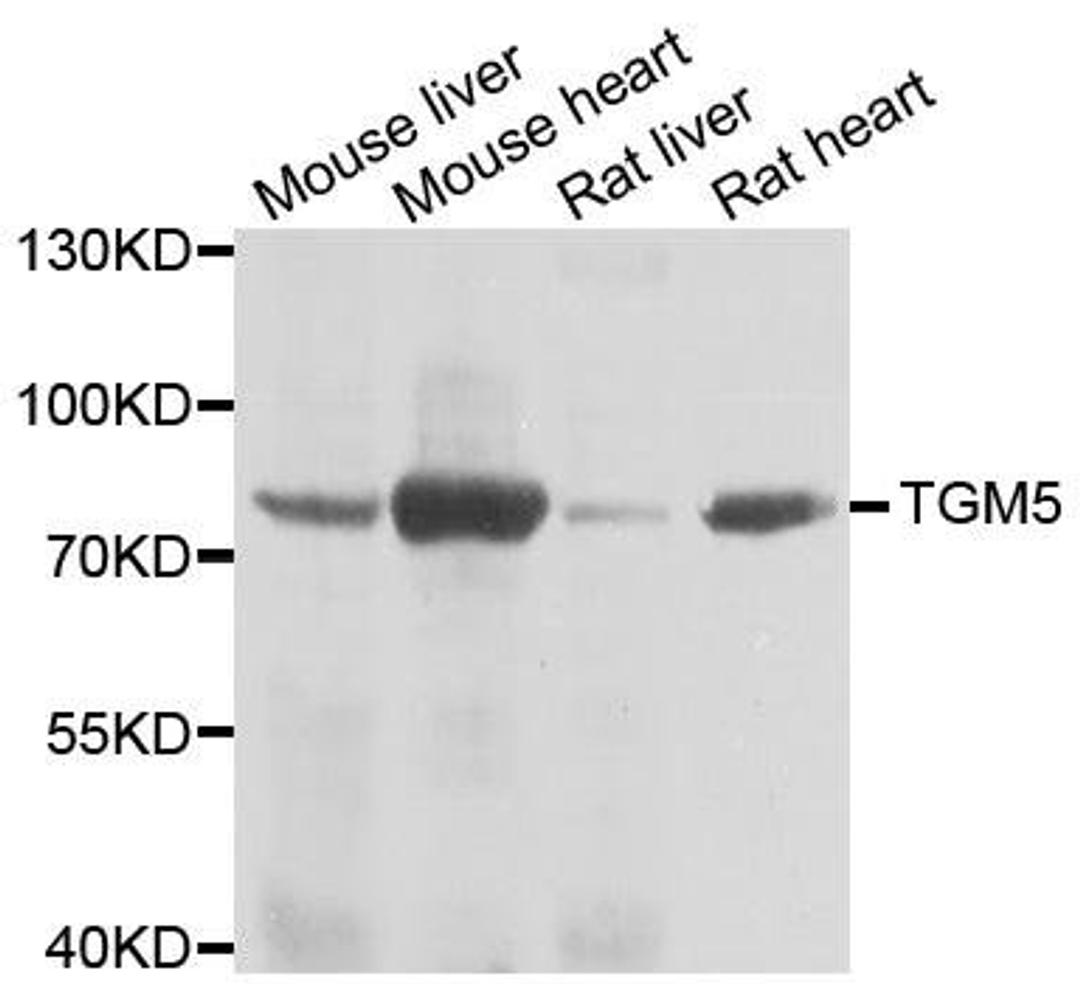 Western blot analysis of extracts of various cell lines using TGM5 antibody