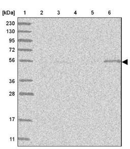 Western Blot: Protein phosphatase 1F Antibody [NBP1-88206] - Lane 1: Marker [kDa] 230, 130, 95, 72, 56, 36, 28, 17, 11<br/>Lane 2: Human cell line RT-4<br/>Lane 3: Human cell line U-251MG sp<br/>Lane 4: Human plasma (IgG/HSA depleted)<br/>Lane 5: Human liver tissue<br/>Lane 6: Human tonsil tissue