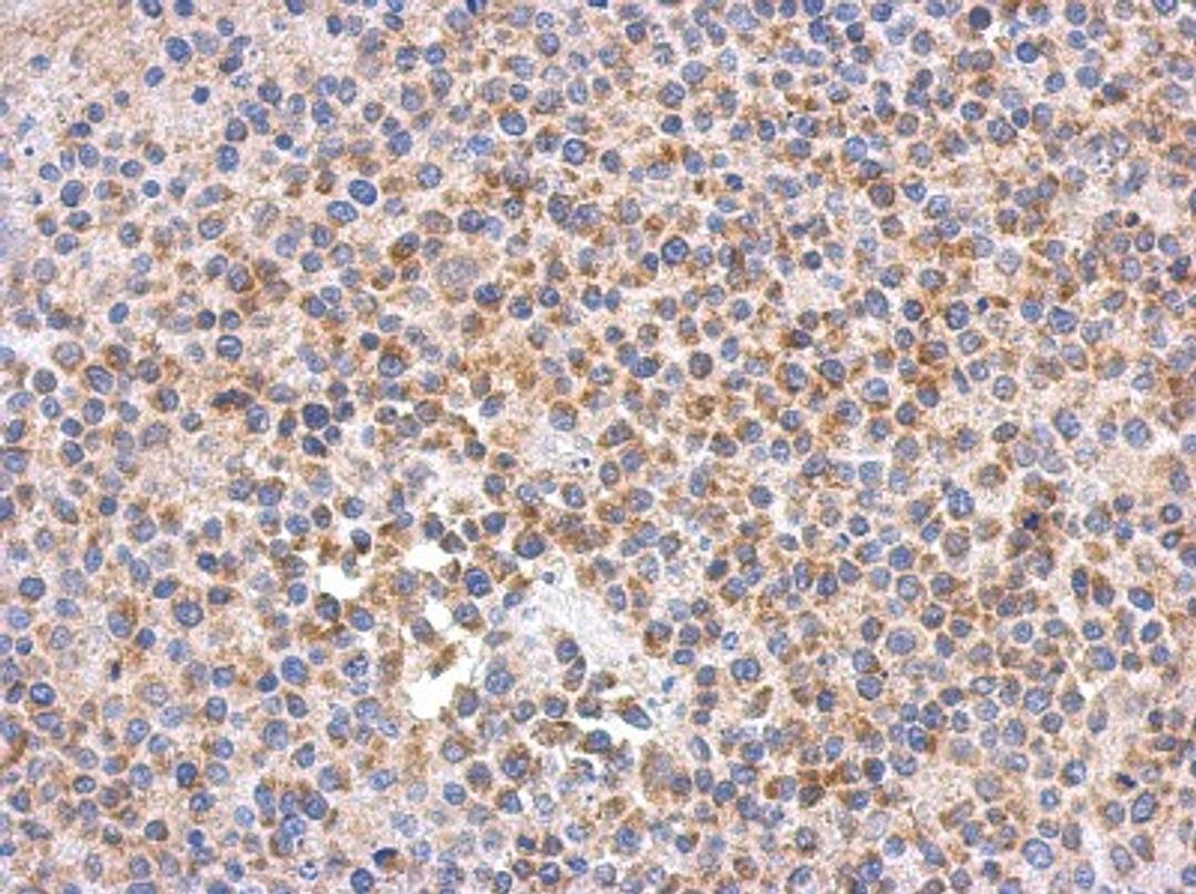 Immunohistochemistry-Paraffin: C9orf114 Antibody [NBP2-15653] - Immunohistochemical analysis of paraffin-embedded J5 xenograft, using antibody at 1:500 dilution.