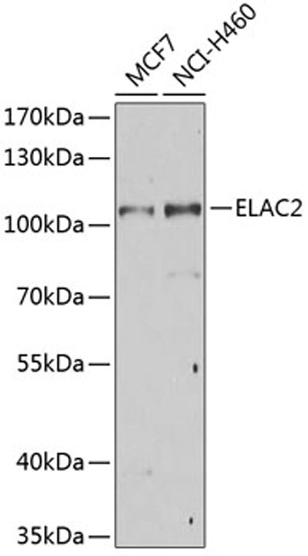 Western blot - ELAC2 Antibody (A7128)