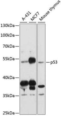 Western blot - p53 antibody (A11232)