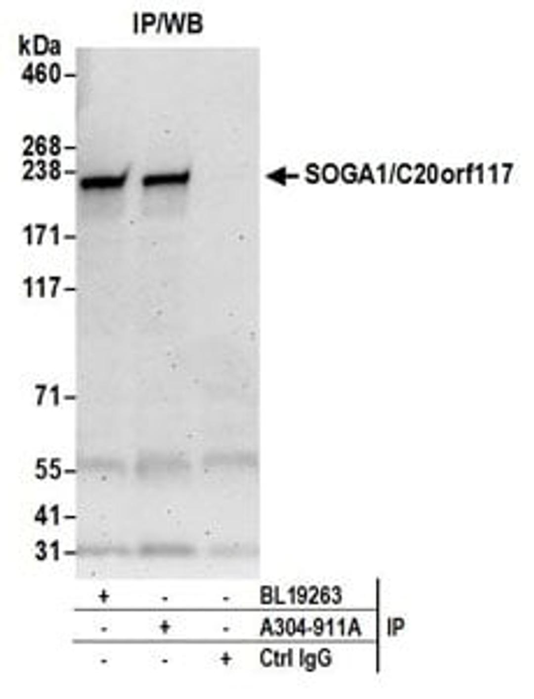 Detection of human SOGA1/C20orf117 by western blot of immunoprecipitates.