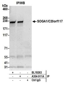 Detection of human SOGA1/C20orf117 by western blot of immunoprecipitates.