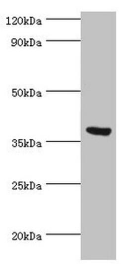 Western blot. All lanes: Peptidyl-prolyl cis-trans isomerase FKBP4 antibody at 0.5ug/ml + MCF-7 whole cell lysate. Secondary. Goat polyclonal to rabbit IgG at 1/10000 dilution. Predicted band size: 52 kDa. Observed band size: 52 kDa. 