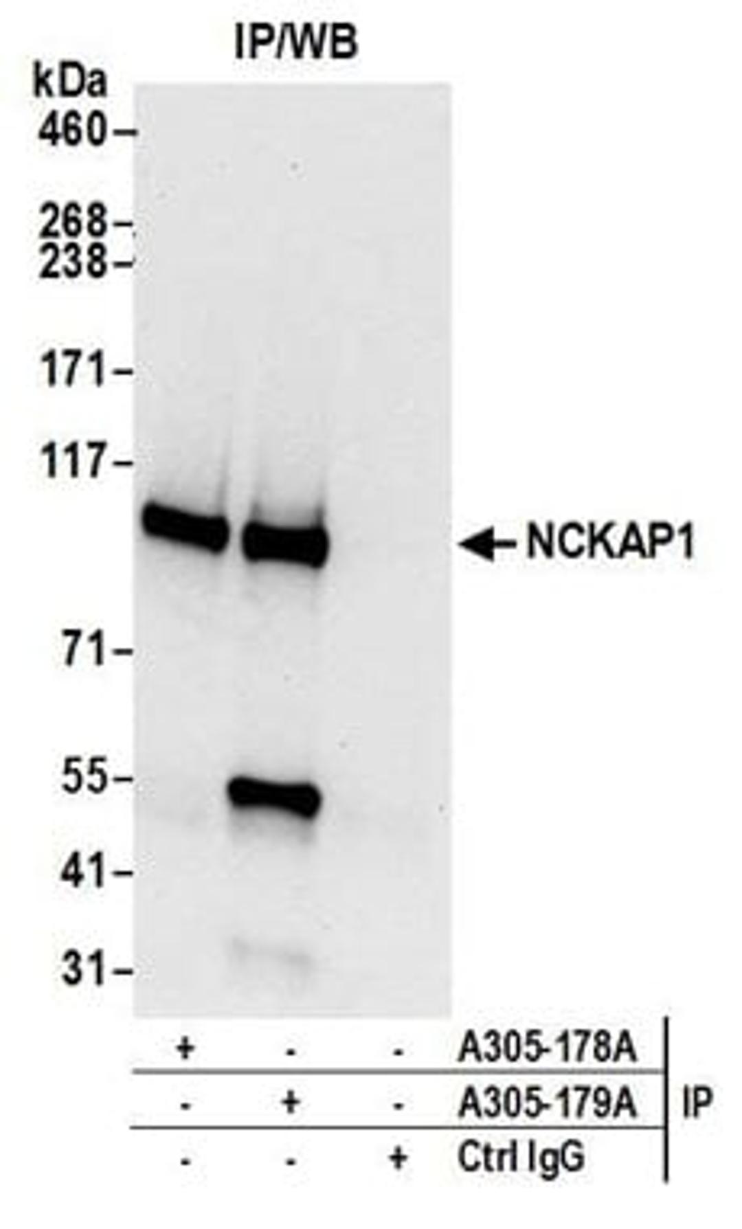 Detection of human NCKAP1 by western blot of immunoprecipitates.