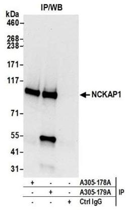 Detection of human NCKAP1 by western blot of immunoprecipitates.