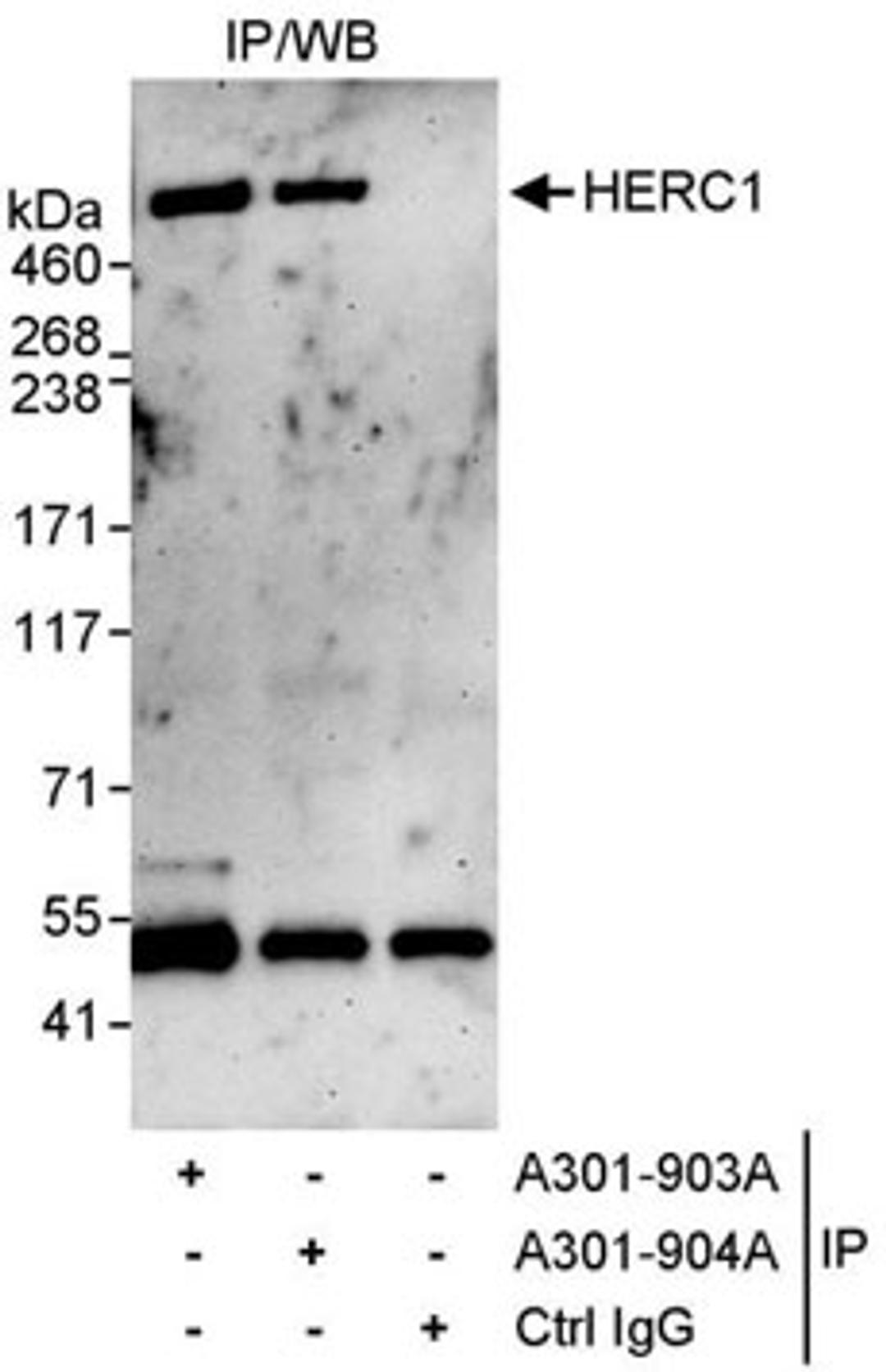 Detection of human HERC1 by western blot of immunoprecipitates.