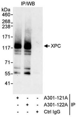 Detection of human XPC by western blot of immunoprecipitates.