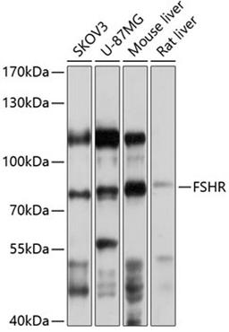 Western blot - FSHR antibody (A1480)