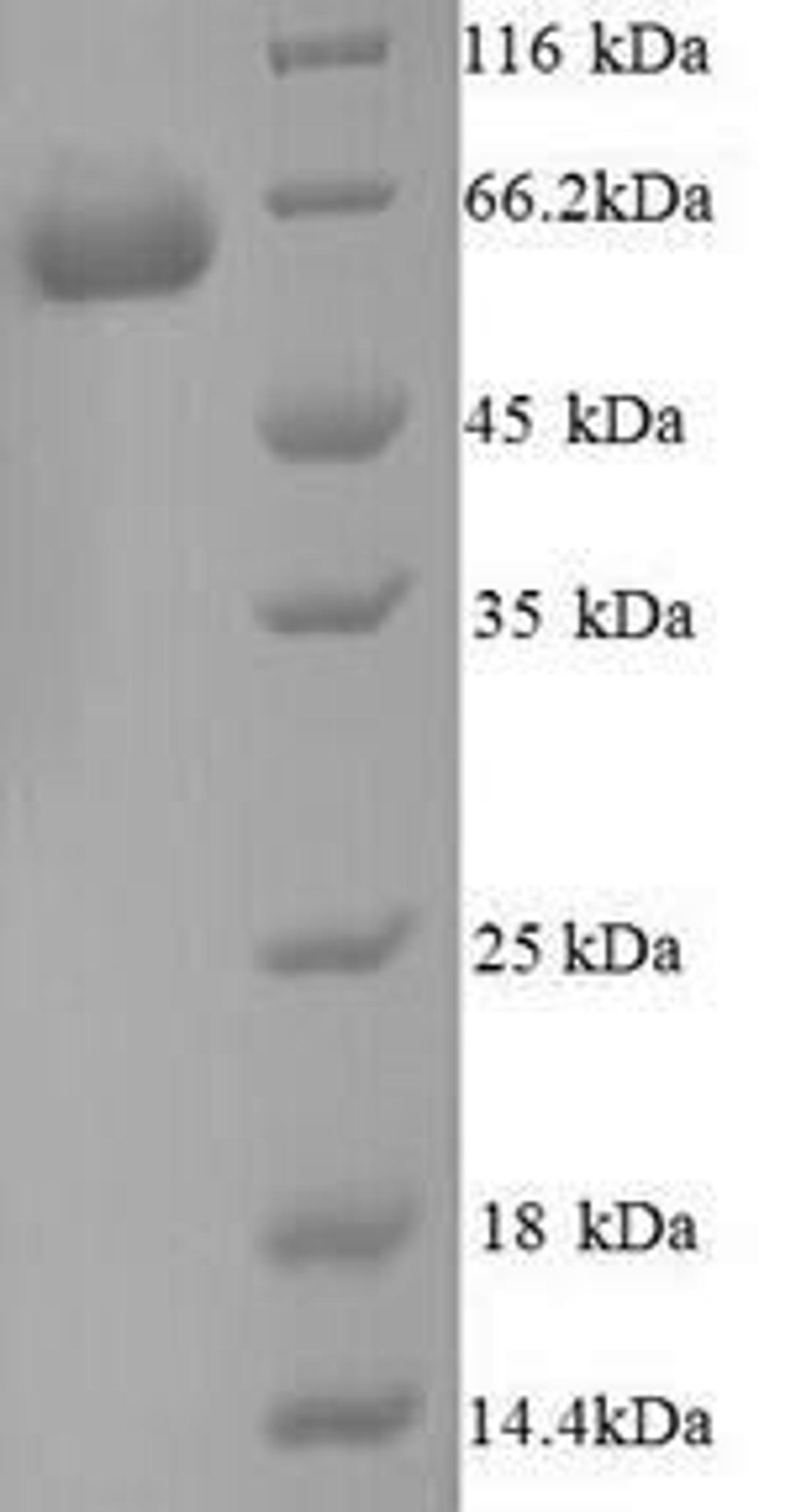 (Tris-Glycine gel) Discontinuous SDS-PAGE (reduced) with 5% enrichment gel and 15% separation gel.
