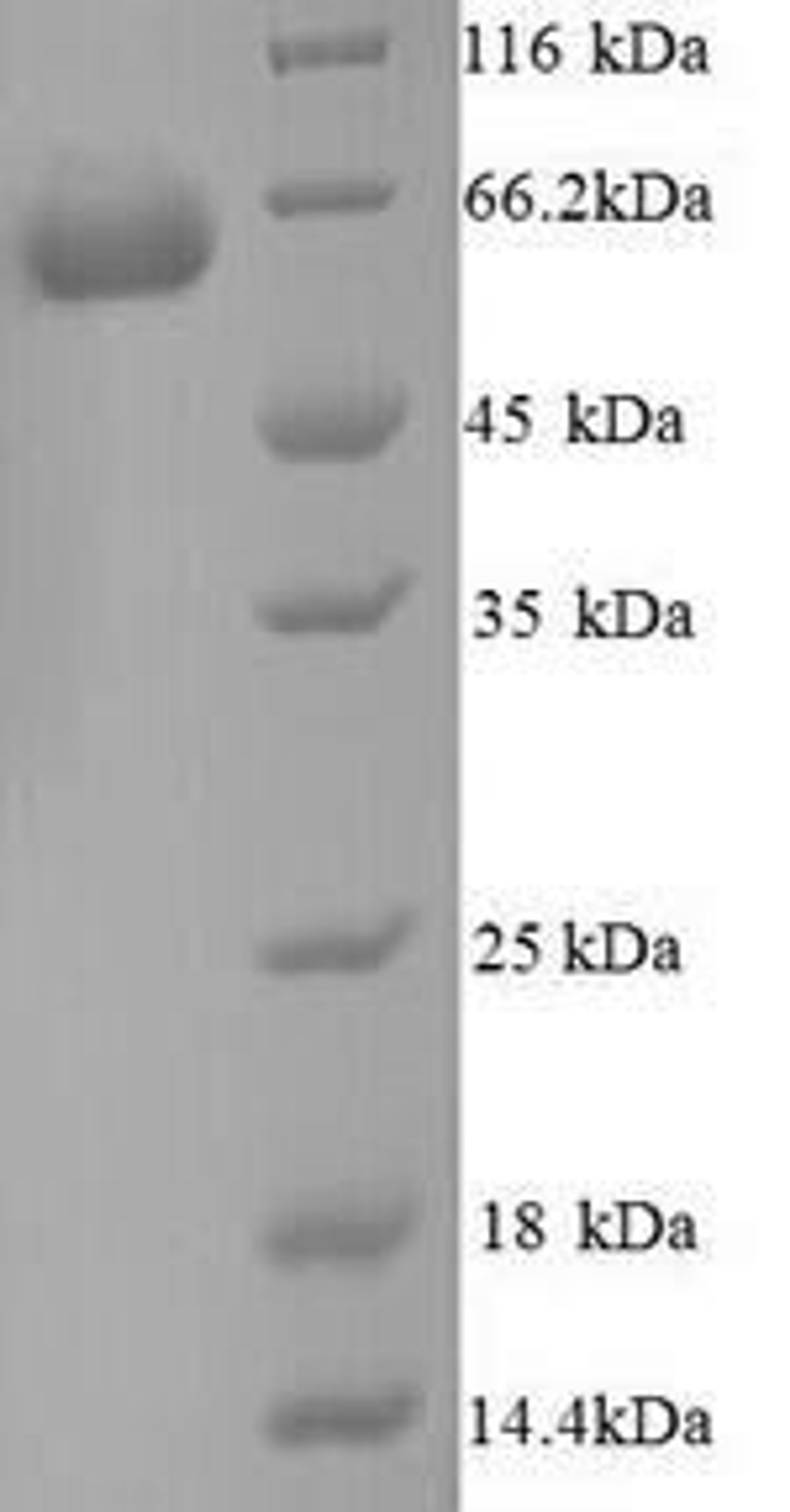 (Tris-Glycine gel) Discontinuous SDS-PAGE (reduced) with 5% enrichment gel and 15% separation gel.