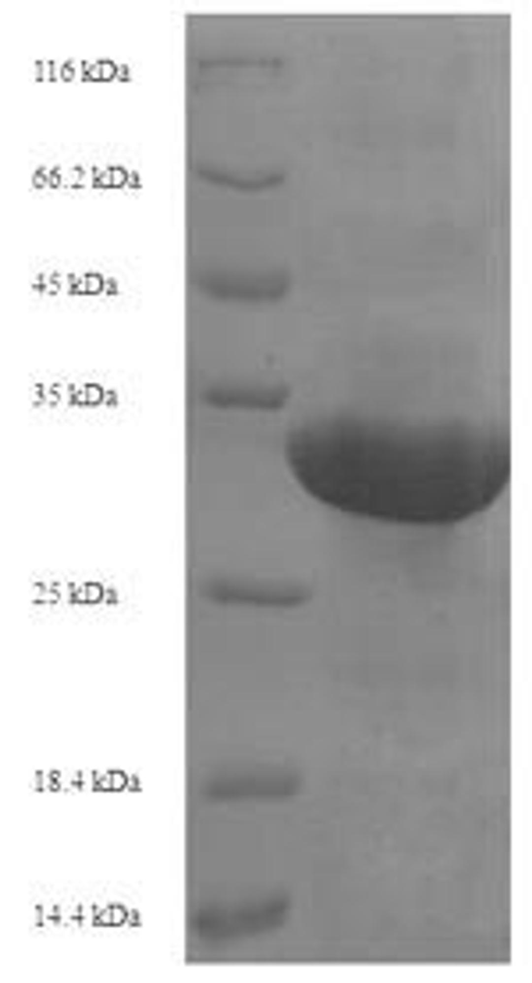 (Tris-Glycine gel) Discontinuous SDS-PAGE (reduced) with 5% enrichment gel and 15% separation gel.