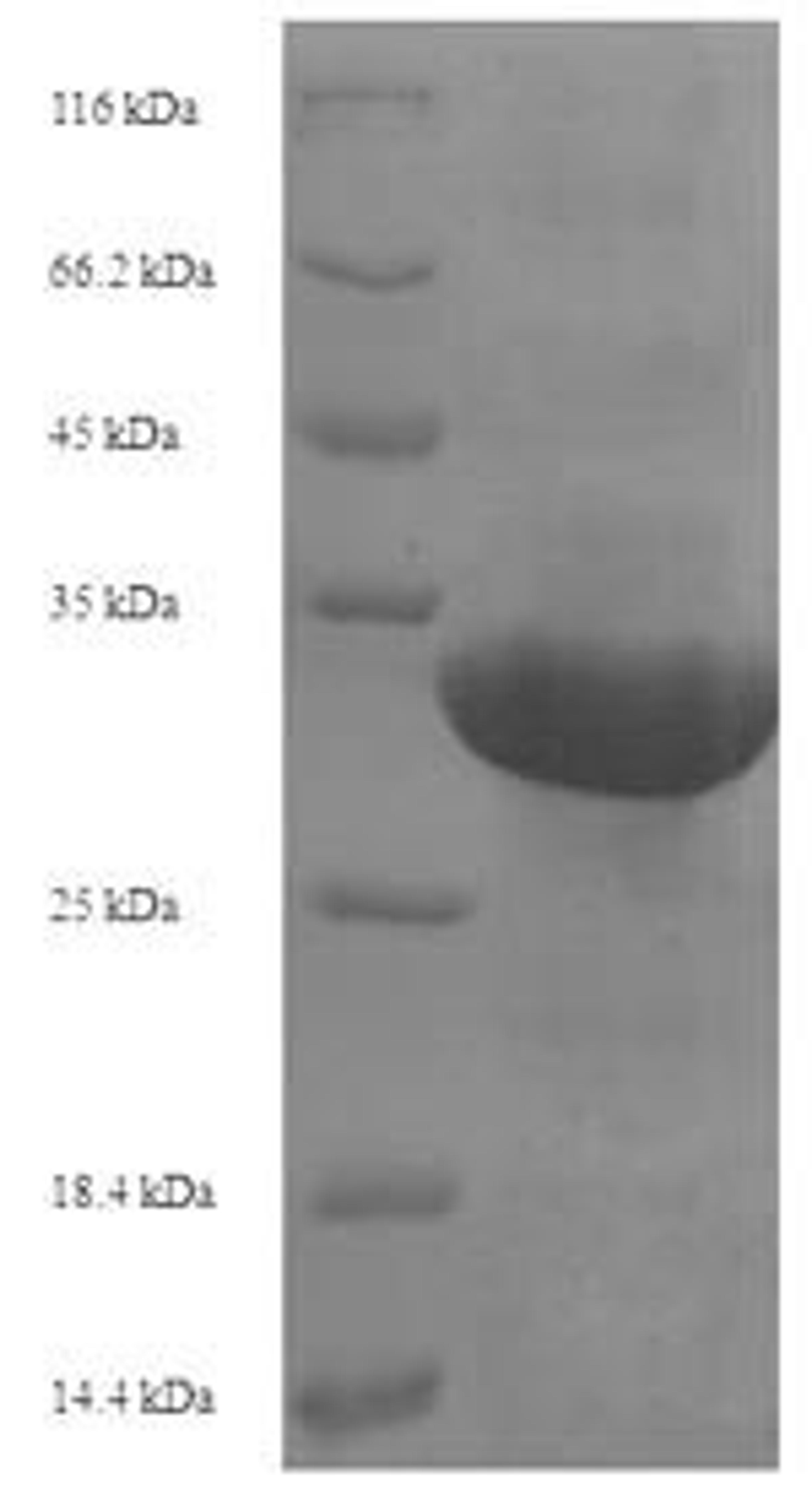 (Tris-Glycine gel) Discontinuous SDS-PAGE (reduced) with 5% enrichment gel and 15% separation gel.
