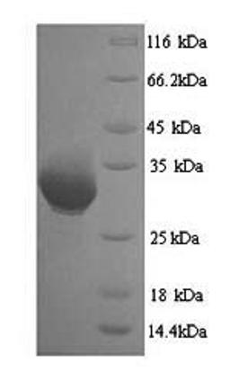 (Tris-Glycine gel) Discontinuous SDS-PAGE (reduced) with 5% enrichment gel and 15% separation gel.