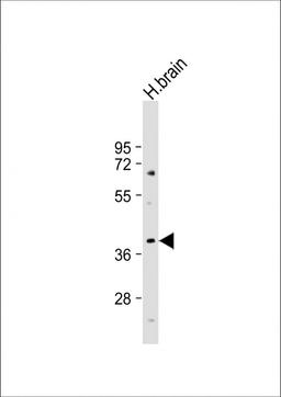 Western Blot at 1:1000 dilution + human brain lysate Lysates/proteins at 20 ug per lane.