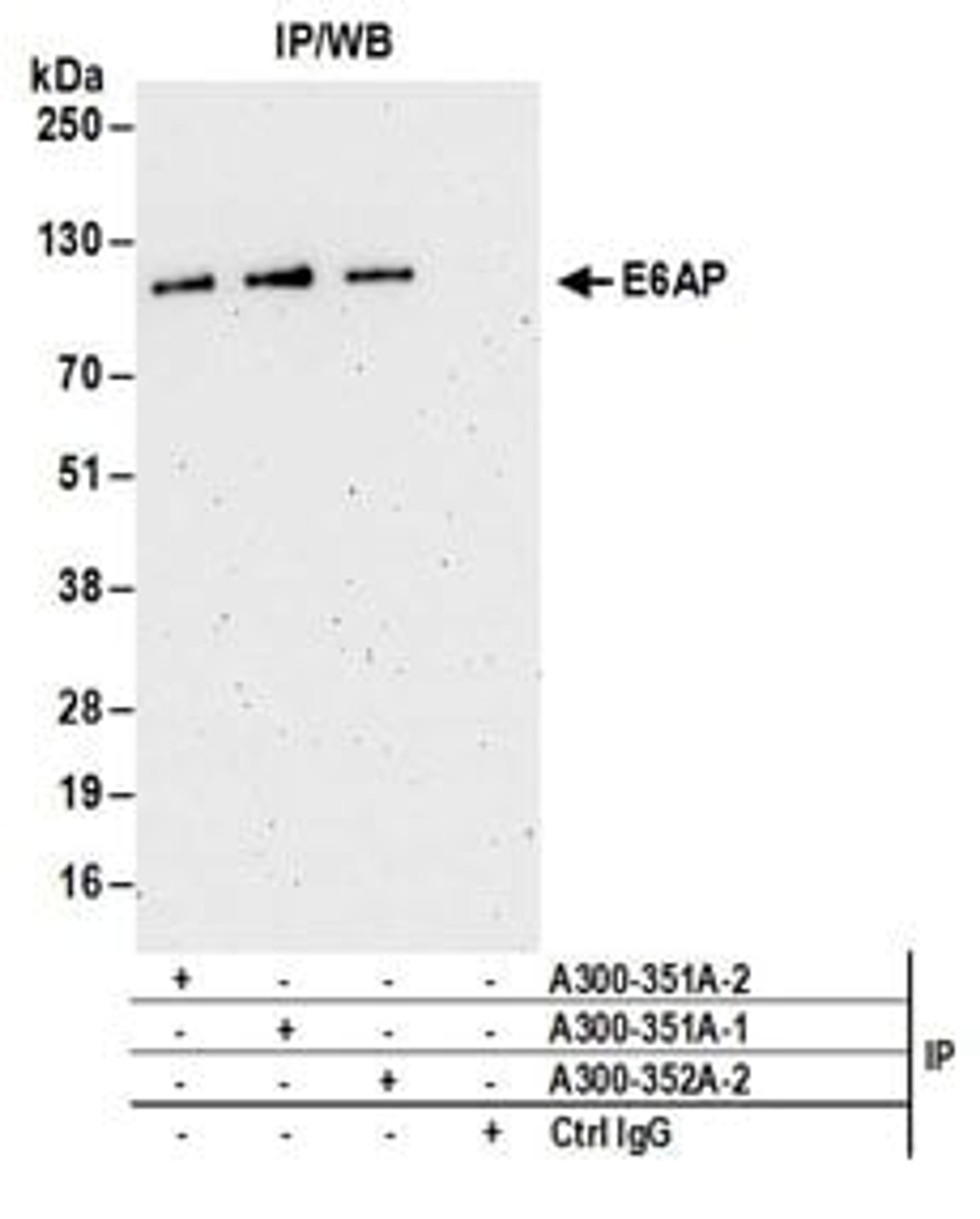 Detection of human E6AP by western blot of immunoprecipitates.