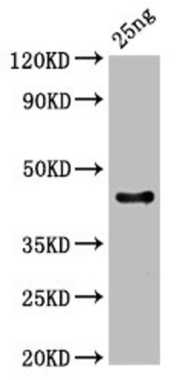 Western Blot. Positive WB detected in Recombinant protein. All lanes: C antibody at 3µg/ml. Secondary. Goat polyclonal to rabbit IgG at 1/50000 dilution. Predicted band size: 44 kDa. Observed band size: 44 kDa