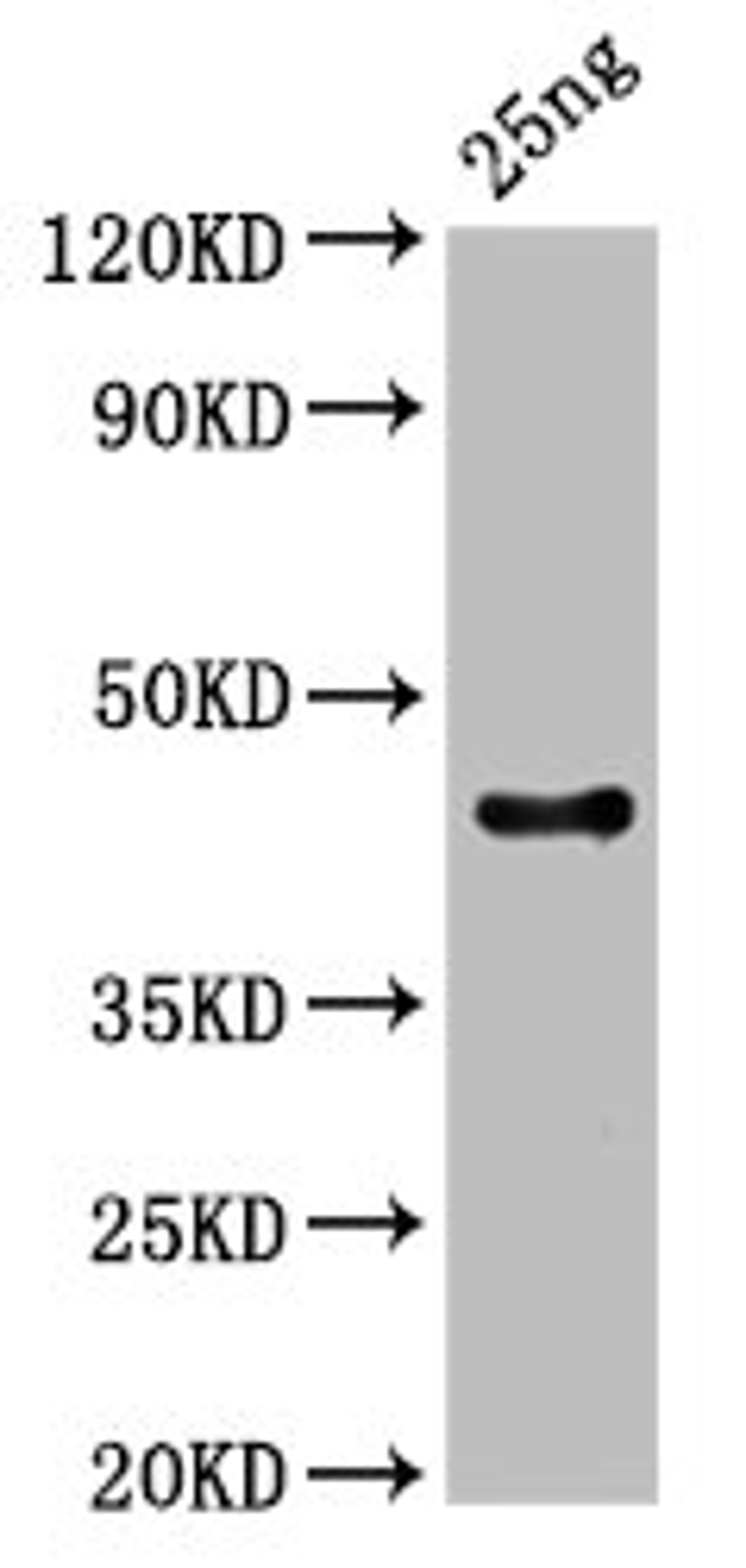 Western Blot. Positive WB detected in Recombinant protein. All lanes: C antibody at 3µg/ml. Secondary. Goat polyclonal to rabbit IgG at 1/50000 dilution. Predicted band size: 44 kDa. Observed band size: 44 kDa