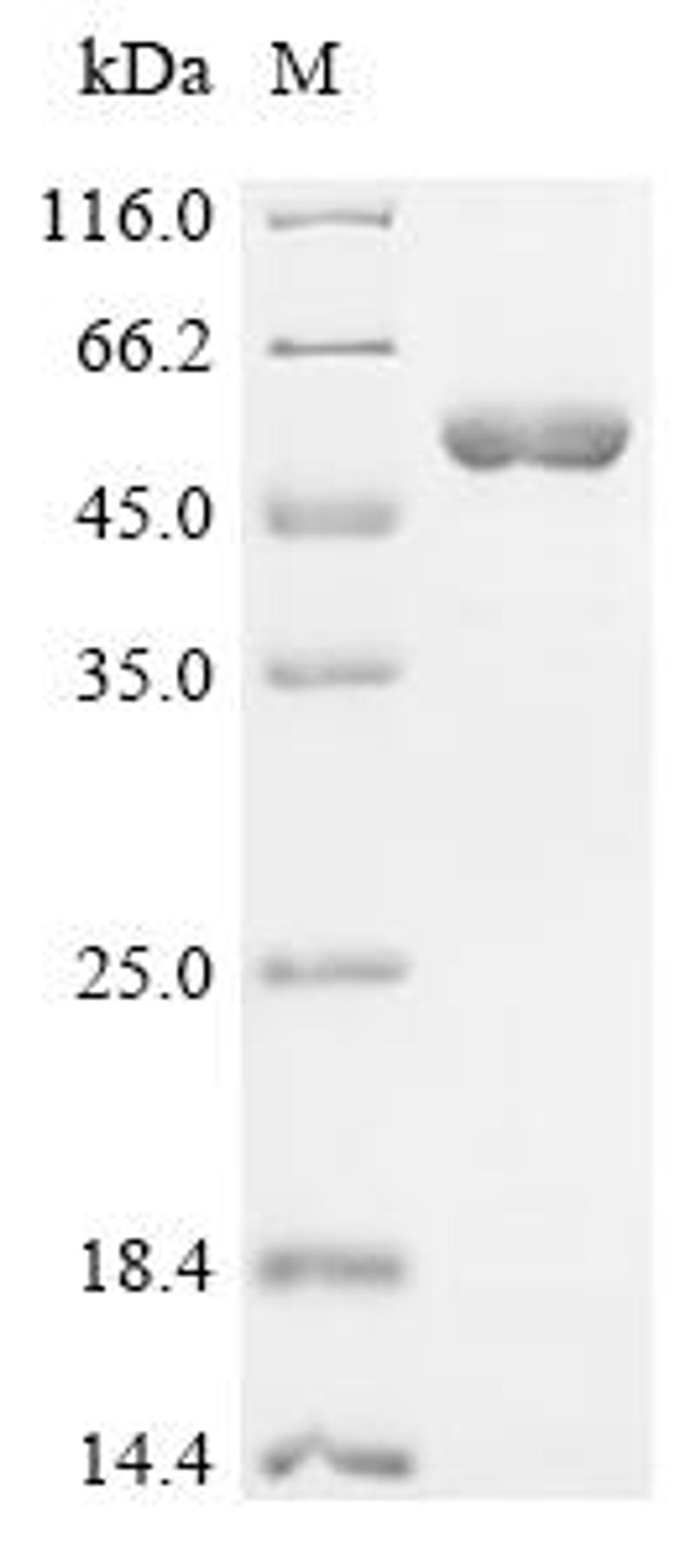 (Tris-Glycine gel) Discontinuous SDS-PAGE (reduced) with 5% enrichment gel and 15% separation gel.