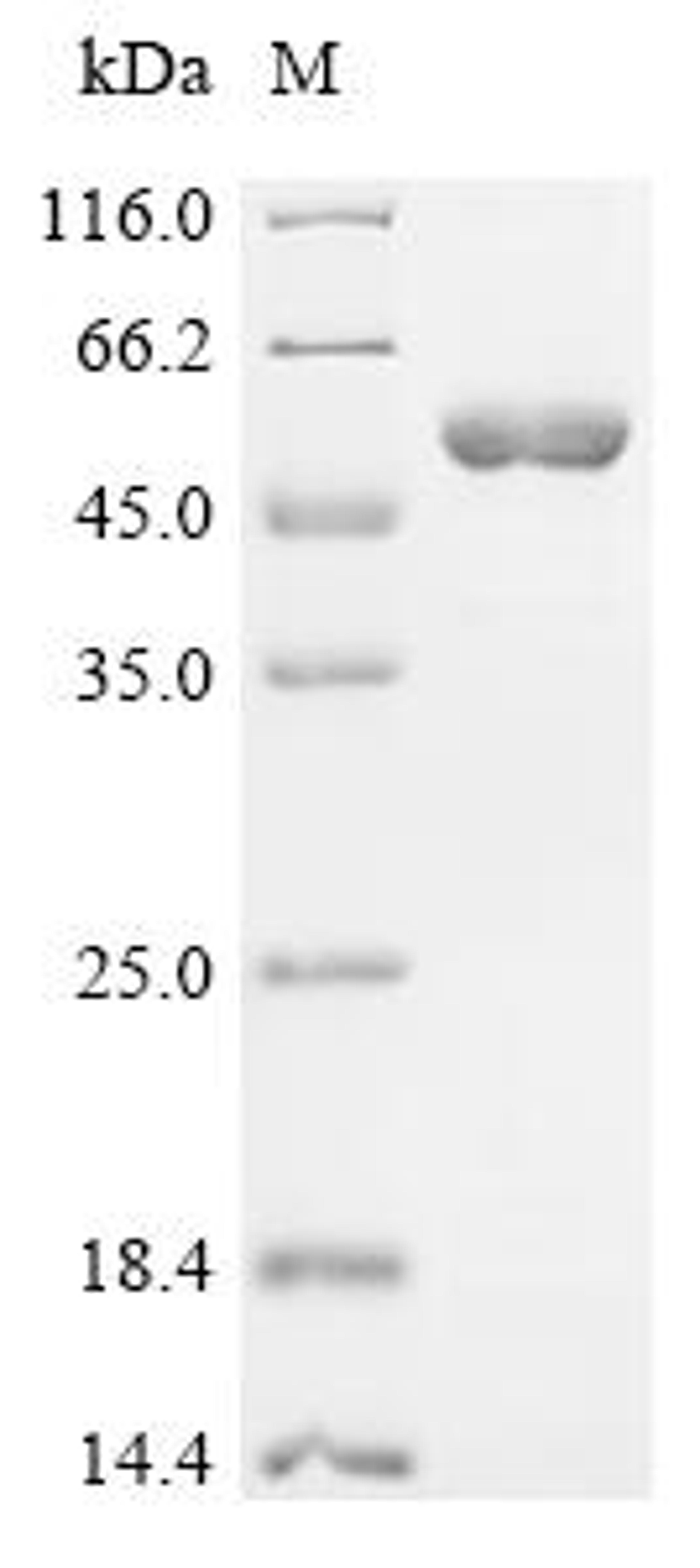 (Tris-Glycine gel) Discontinuous SDS-PAGE (reduced) with 5% enrichment gel and 15% separation gel.