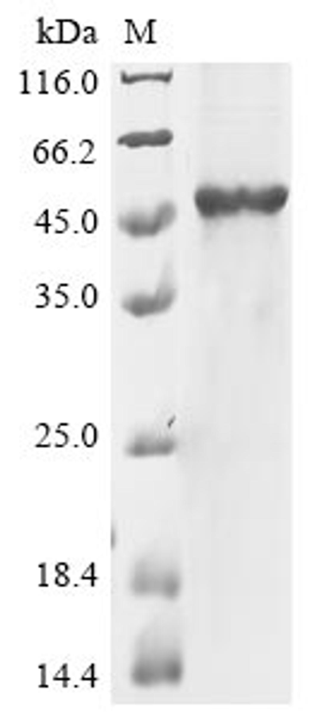 (Tris-Glycine gel) Discontinuous SDS-PAGE (reduced) with 5% enrichment gel and 15% separation gel.