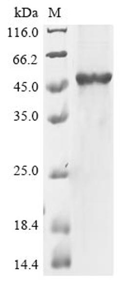 (Tris-Glycine gel) Discontinuous SDS-PAGE (reduced) with 5% enrichment gel and 15% separation gel.